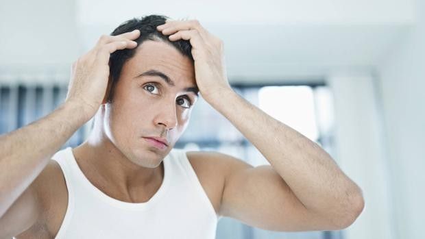 Cinco problemas capilares, más allá de la alopecia