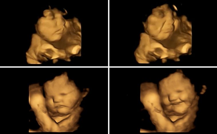 Bebés reaccionan en el útero a lo que comen sus madres: 'sonrisas' a las zanahorias y muecas de disgusto por las coles