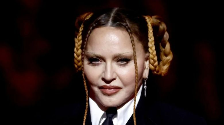 La nueva cara de Madonna podría ser todo un manifiesto y una provocación