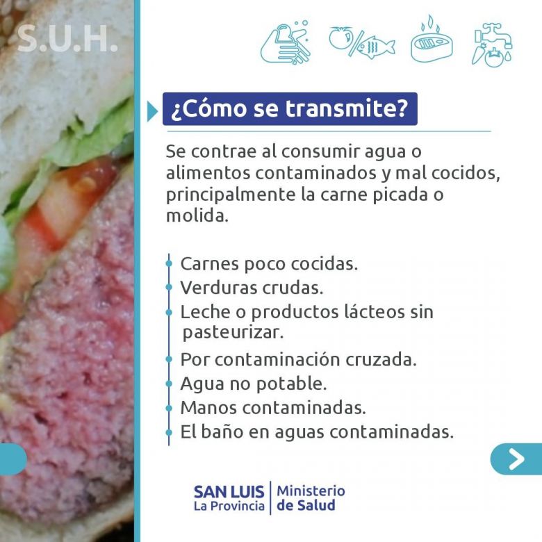 Lanzan recomendaciones para prevenir el S&iacute;ndrome Ur&eacute;mico Hemol&iacute;tico (SUH)